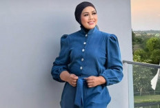 Elly Sugigi Jalani Operasi Plastik, Akui Ingin Tingkatkan Kepercayaan Diri